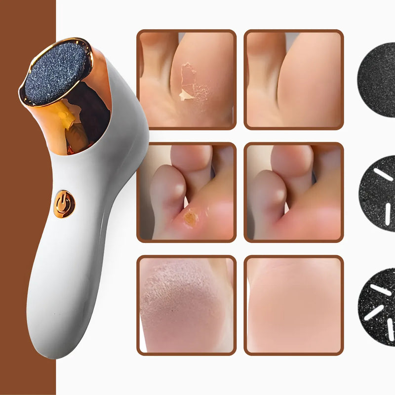 Kit Removedor Elétrico de Calos para Pés  Branco